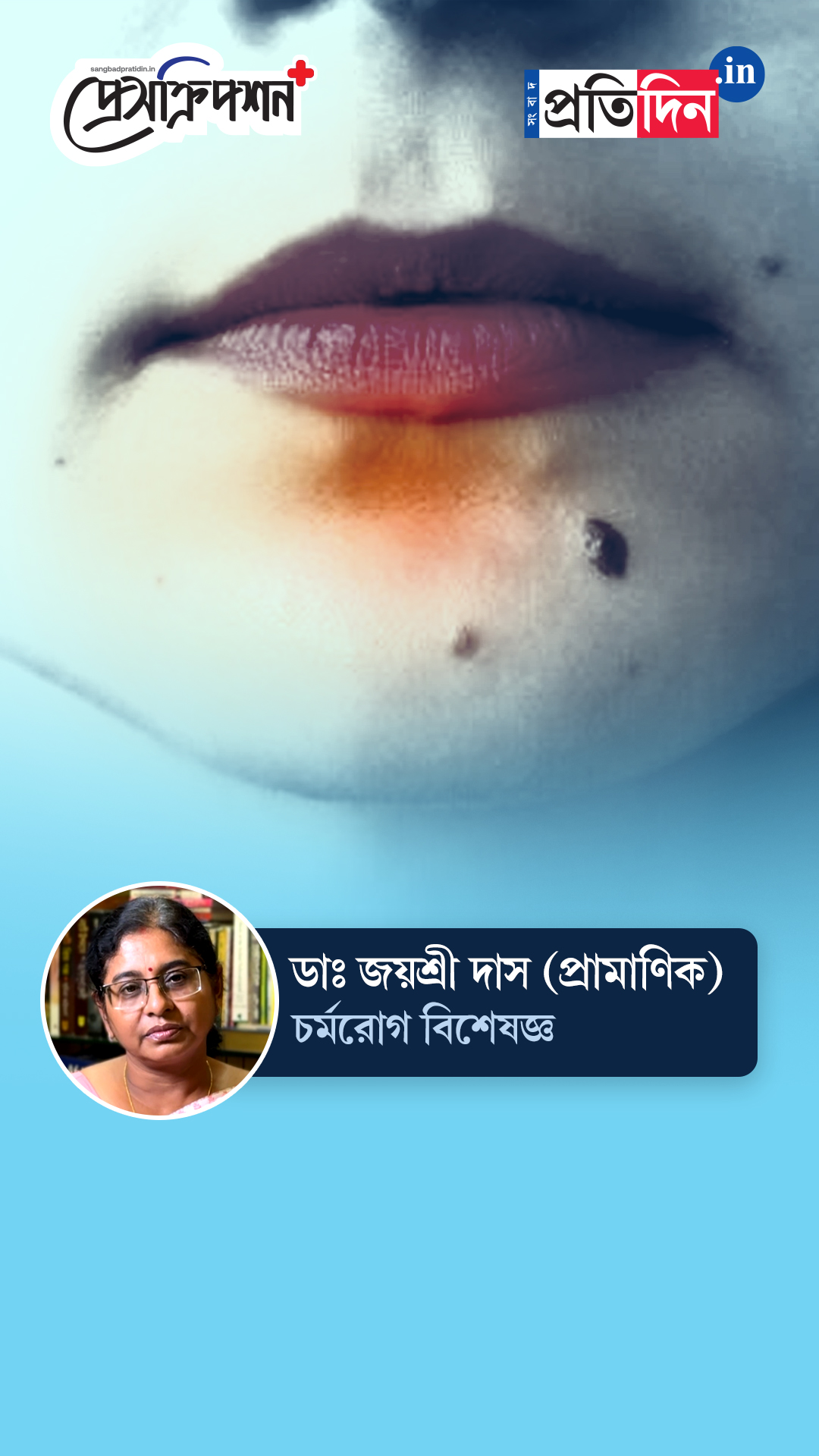 Skin Health| Prescription Plus| তিল থেকে কি ক্যানসার হতে পারে? জানাচ্ছেন ডাঃ জয়শ্রী প্রামাণিক দাস